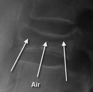 x-ray image 