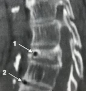 x-ray image