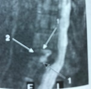MRI image