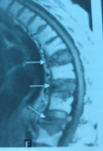 MRI image